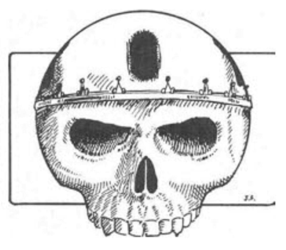 user avatar image for Todd L Lyter